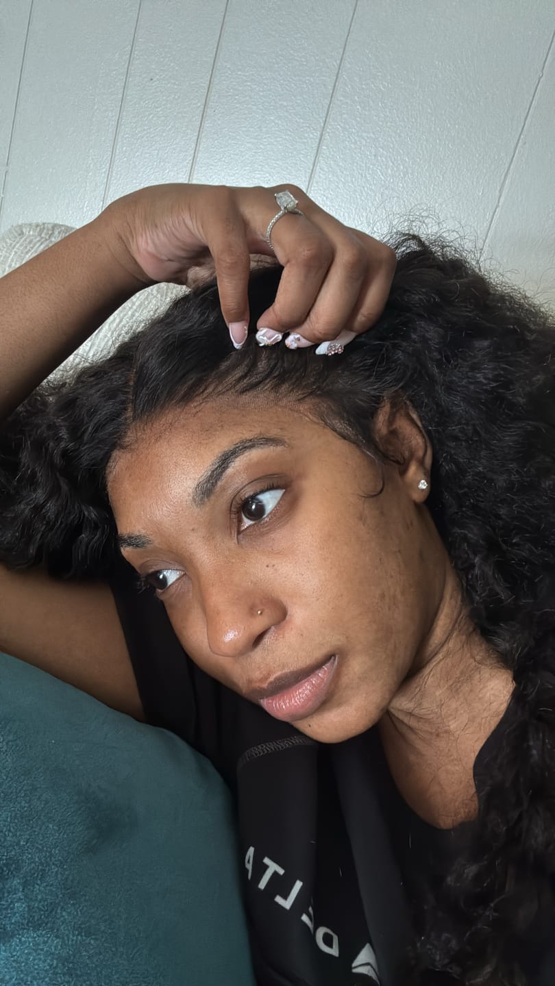 Customer photo review of Jolie’s Full Body & Face Brightening Kit
