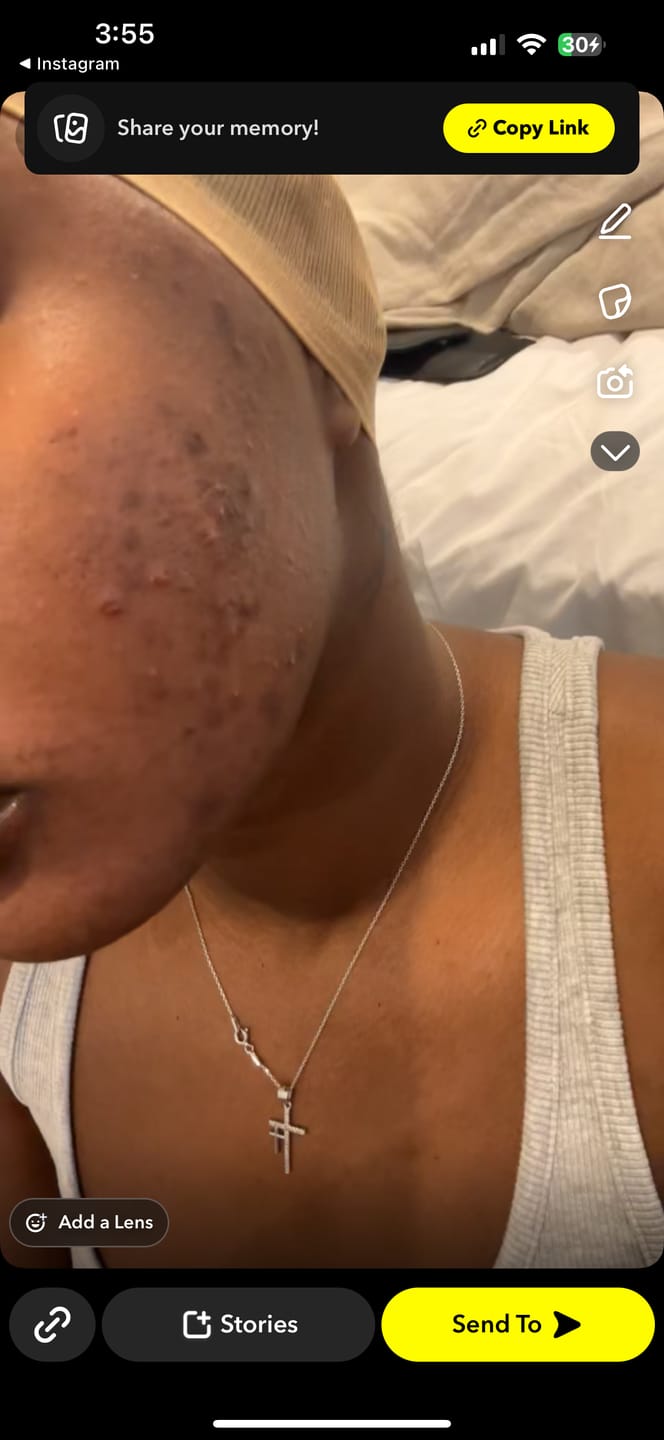Customer photo review of Duo Skincare Bundle