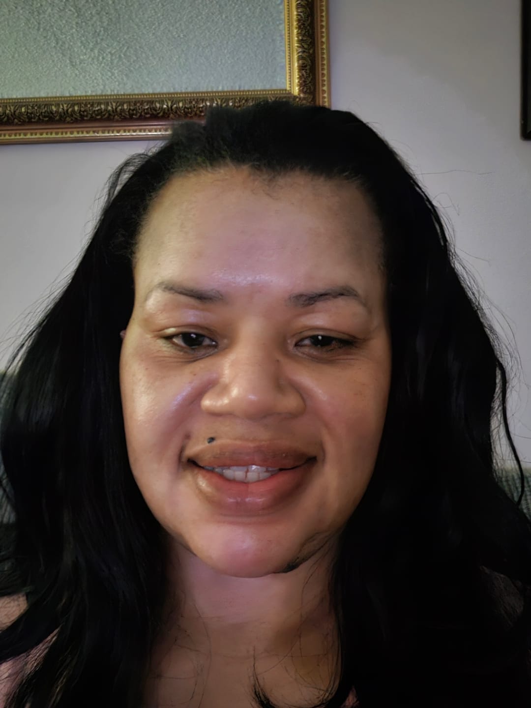 Customer photo review of Target Area Cream