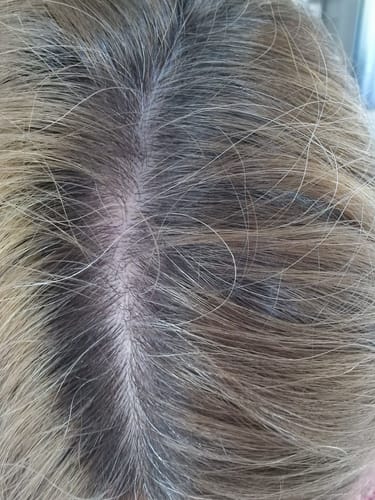 Customer photo review of Sunkissed Starter Kit