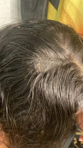 Customer photo review of LACE CLOSURES