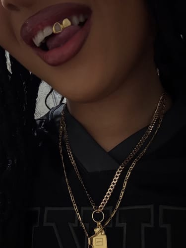 Customer photo review of PRISM (GOLD PLATED GRILLZ)
