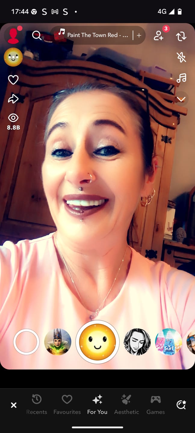 Customer photo review of Click-in Veneers 4.0