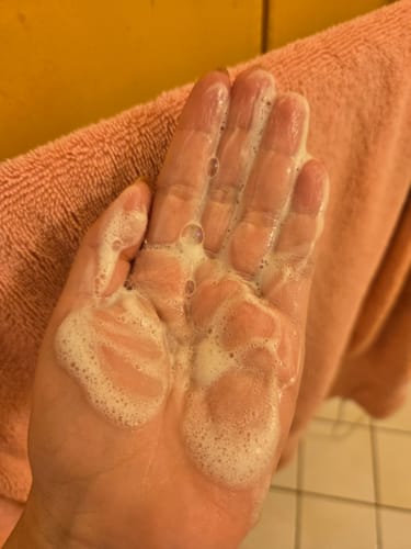 Customer photo review of Daily Facial Cleanser Face Wash for Sensitive, Combination to Oily Skin