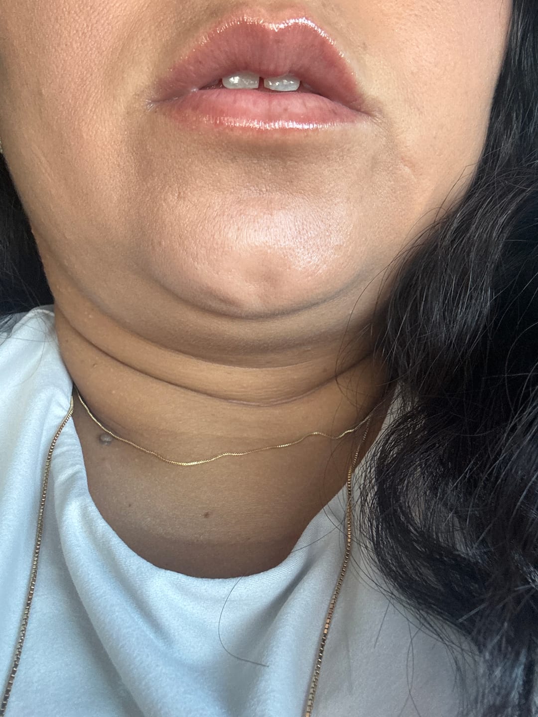 Customer photo review of Triple Lip Plumper Bundle