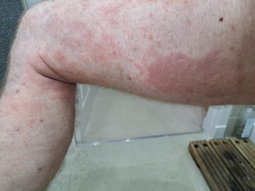 Customer photo review of Seb Natural Calming Serum