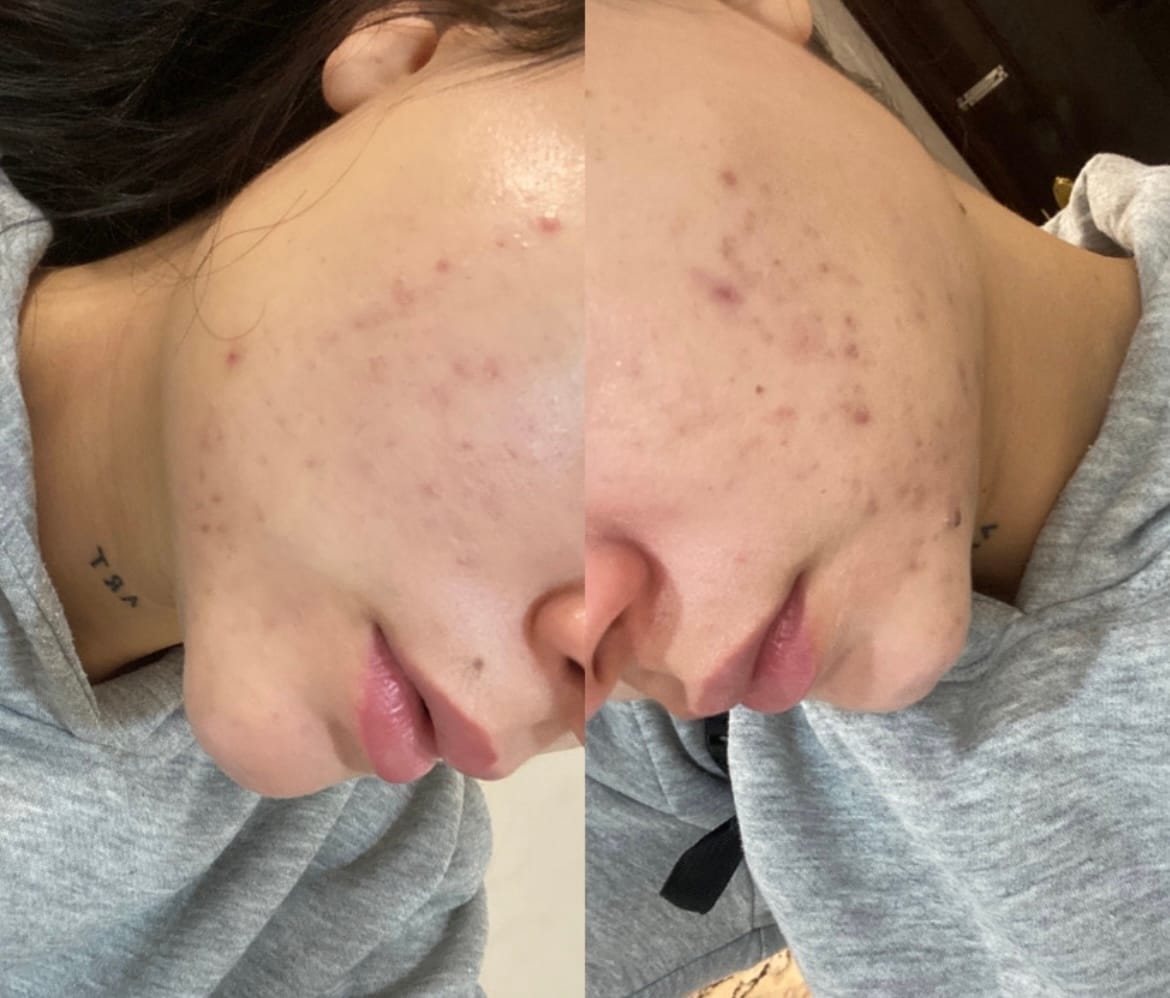 Customer photo review of A.O.X Booster Antioxidante con vitamina C