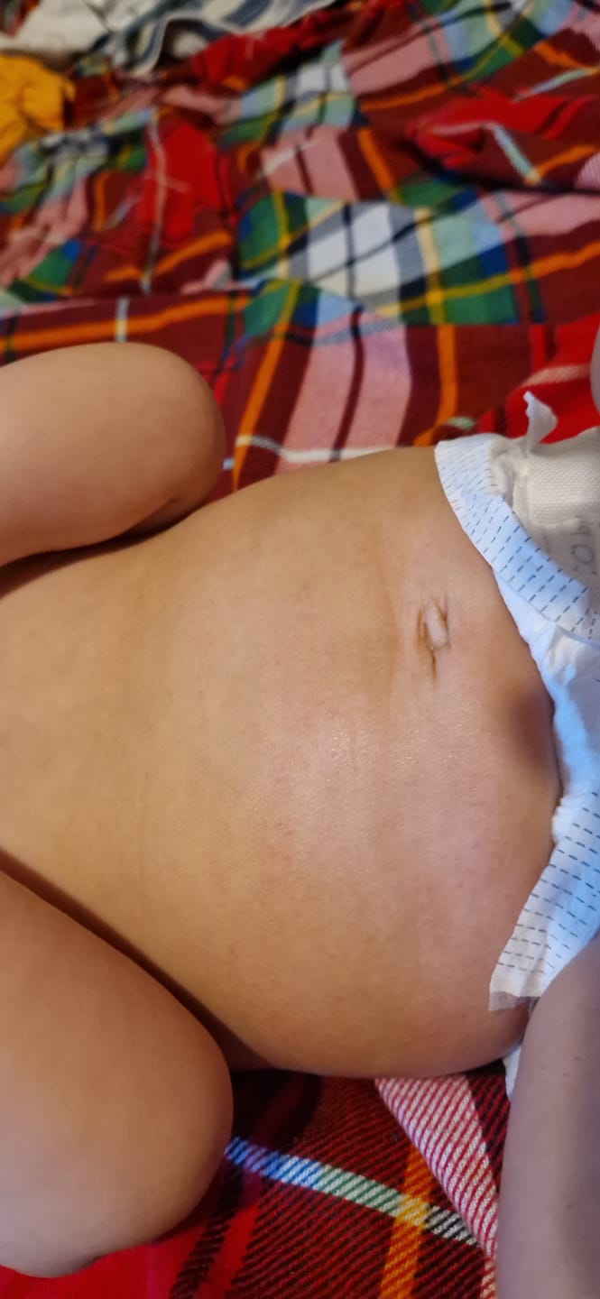 Customer photo review of Bioskin Junior Duo Pack