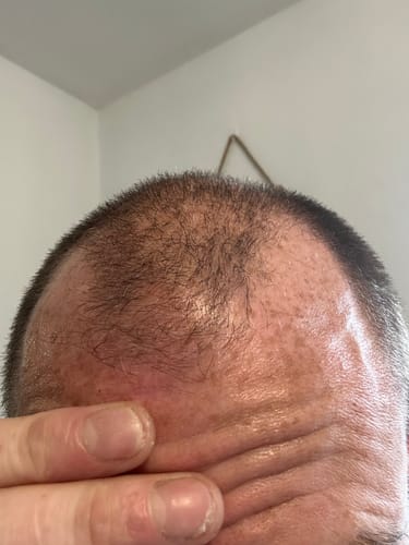 Customer photo review of Seb Natural Soothing Balm