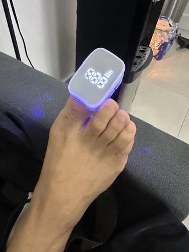 Customer photo review of MyCurePro® Revitalización avanzada antihongos