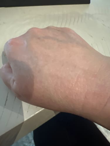 Customer photo review of Neptune Grass Fed Tallow & Honey Balm (Whipped) 4oz