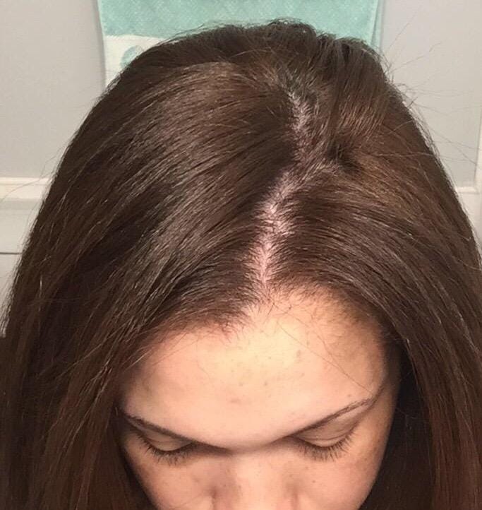 Customer photo review of KERAGEN Brazilian Keratin Smoothing Treatment Formaldehyde-Free Blowout Straightening System