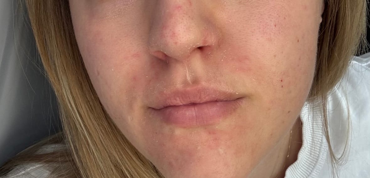 Customer photo review of Purity+ | Нежен крем-клензър с pH 4.89