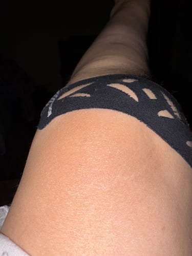Customer photo review of Easy Kinesiology Tape