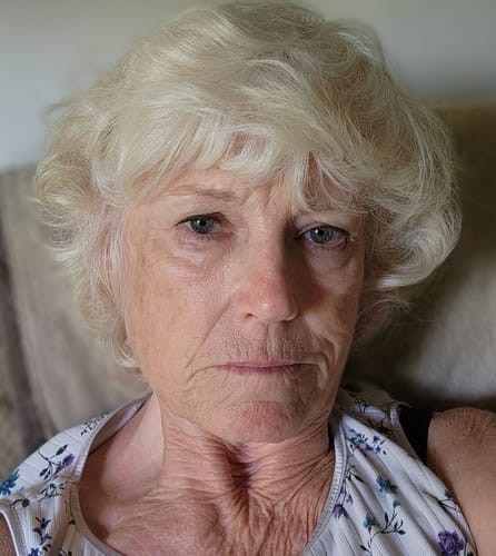 Customer photo review of 3 Month Supply - Seranova Micro Infusion System