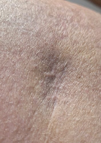 Customer photo review of Healing Balm
