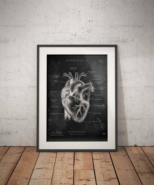 Customer photo review of Herz Anatomie - Chalkboard