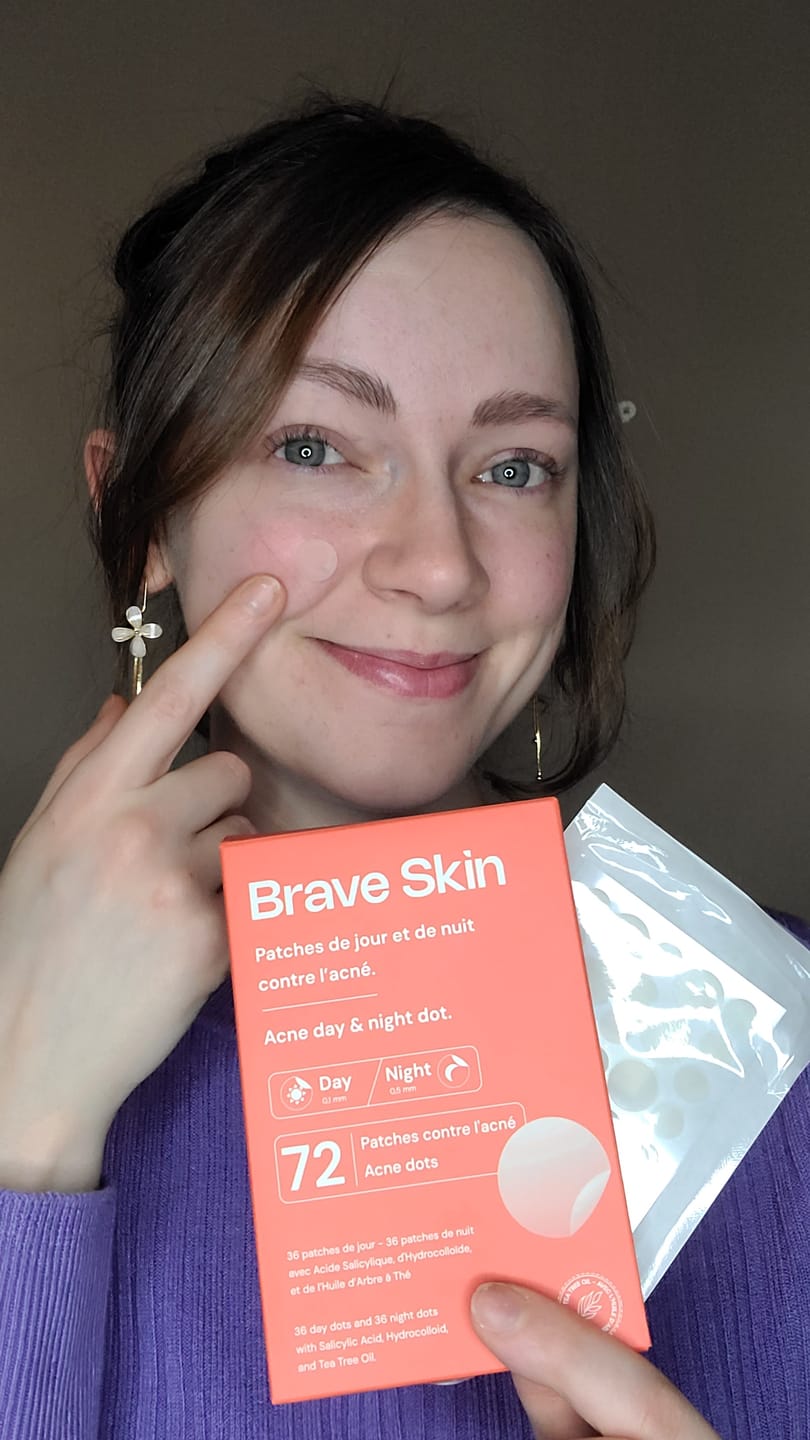 Customer photo review of Brave Skin - Patches de jour et de nuit contre l'acné