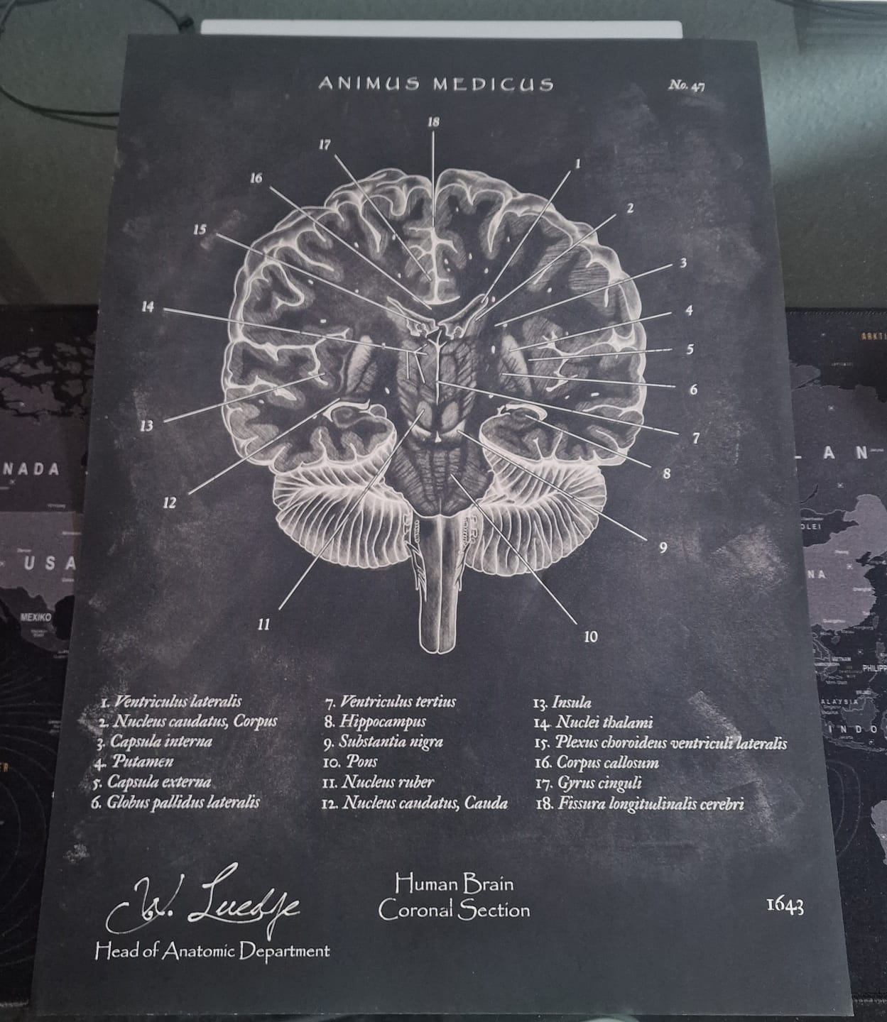 Customer photo review of Gehirn Aufbau im Schnitt - Chalkboard