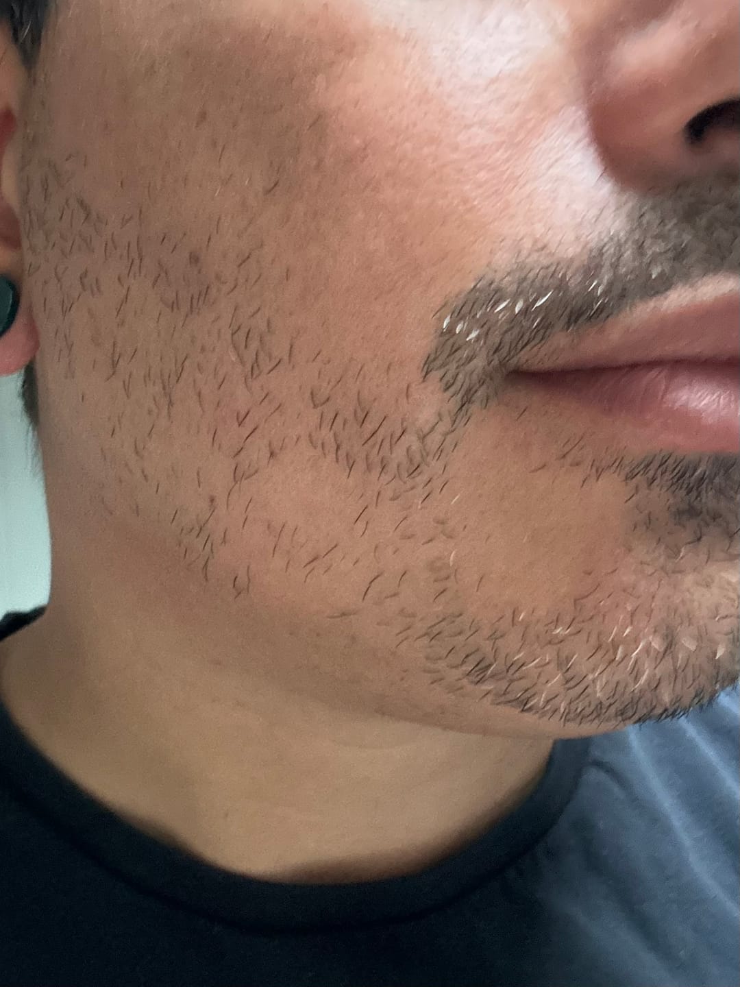 Customer photo review of Activator Serum | Booster Croissance de barbe