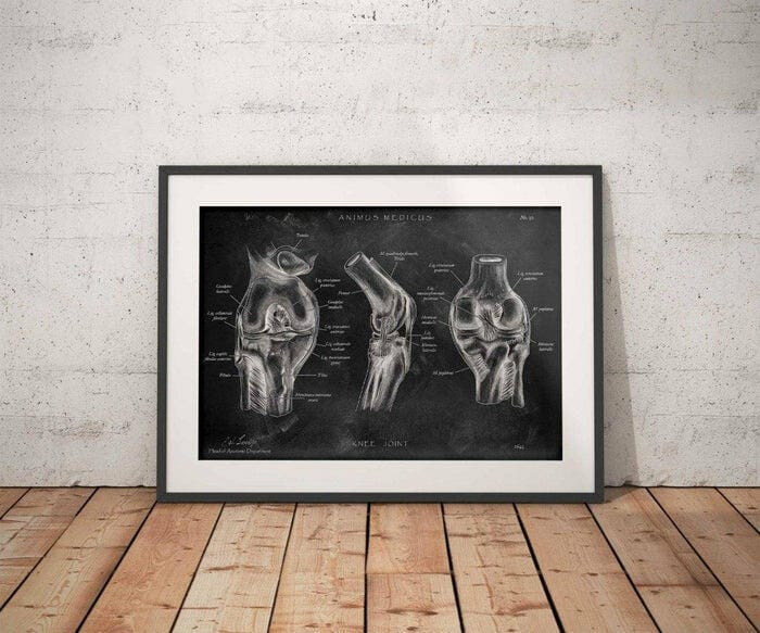 Customer photo review of Kniegelenk Anatomie - Chalkboard