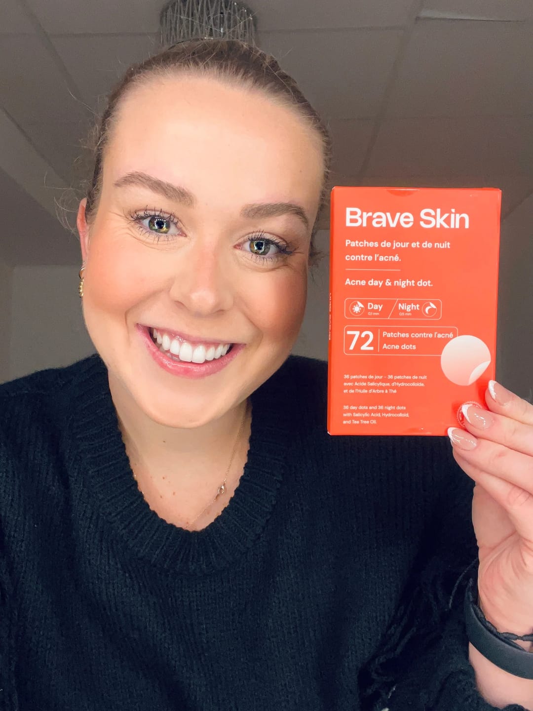 Customer photo review of Brave Skin - Patches de jour et de nuit contre l'acné