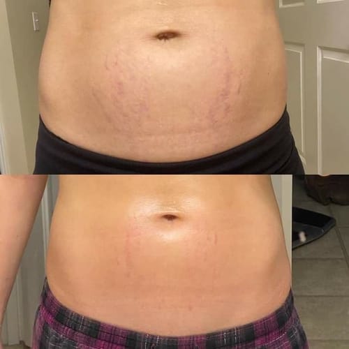 Customer photo review of Eliminá la Celulitis y las Estrías desde la Raíz: Guía Completa para una Piel Suave y Firme + 20 Regalos Extras