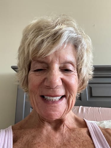 Customer photo review of 3 Month Supply - Seranova Micro Infusion System