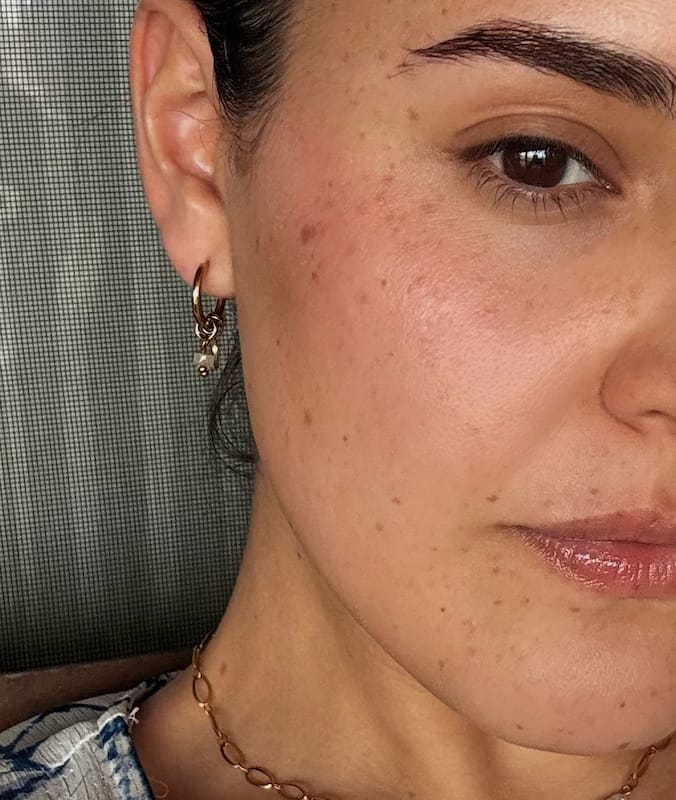 Customer photo review of The 6 Peptide Skin Booster