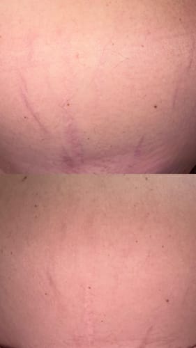 Customer photo review of For Your Buns, Hun