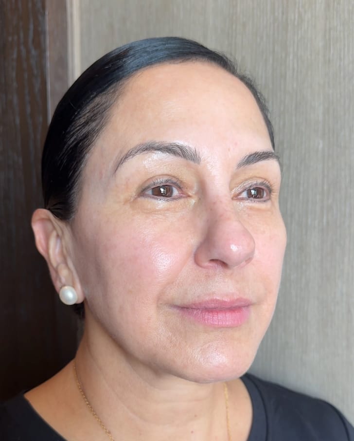 Customer photo review of 4 - Exoreju PDRN Ampoule