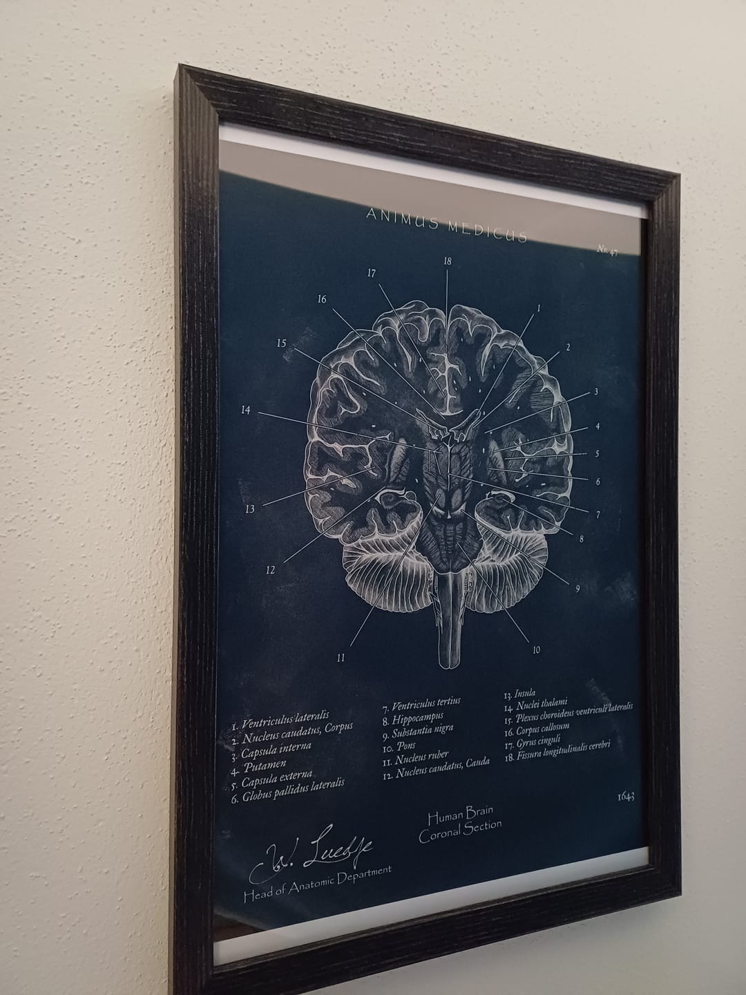 Customer photo review of Gehirn Aufbau im Schnitt - Chalkboard