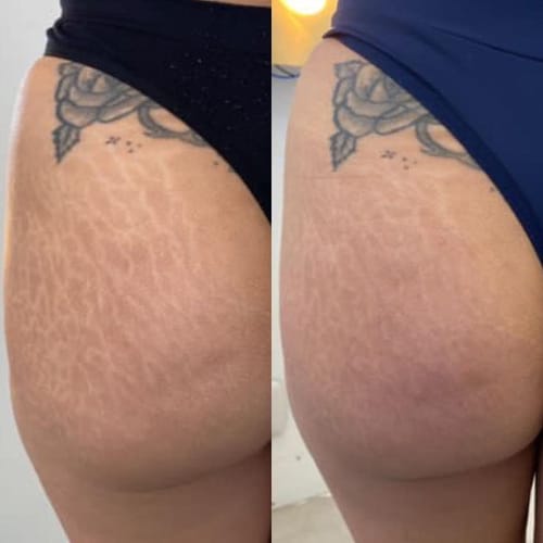 Customer photo review of Eliminá la Celulitis y las Estrías desde la Raíz: Guía Completa para una Piel Suave y Firme + 20 Regalos Extras