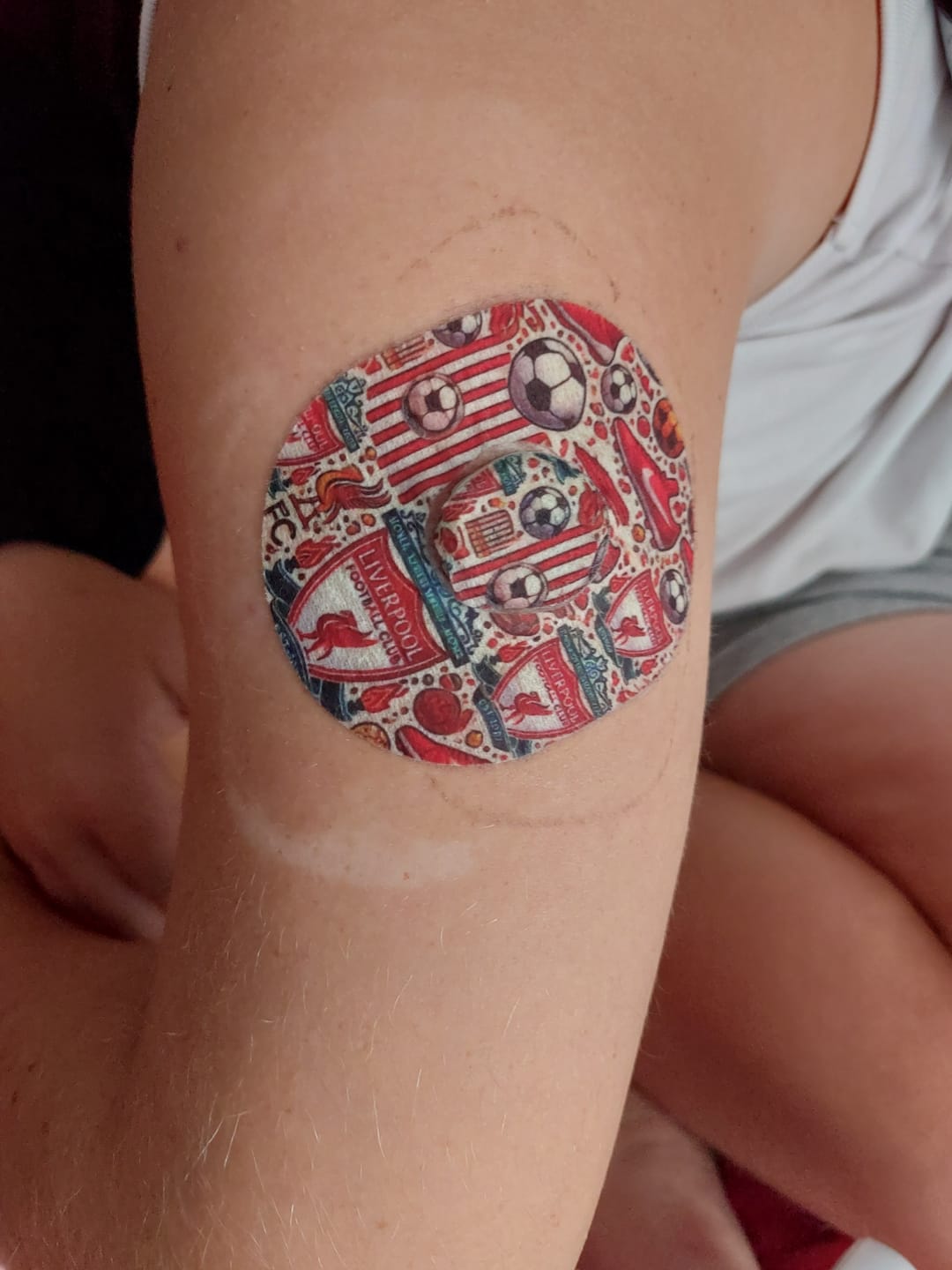 Customer photo review of Liverpool Fotbollclub CGM-sensor overpatches för Dexcom G7 Sensor Ink sensor sticker