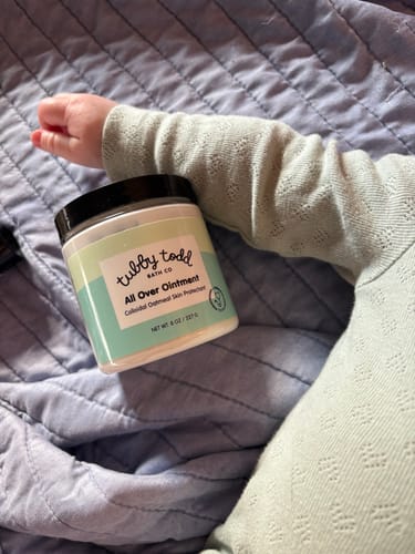 Customer photo review of All Over Ointment Eczema Treatment