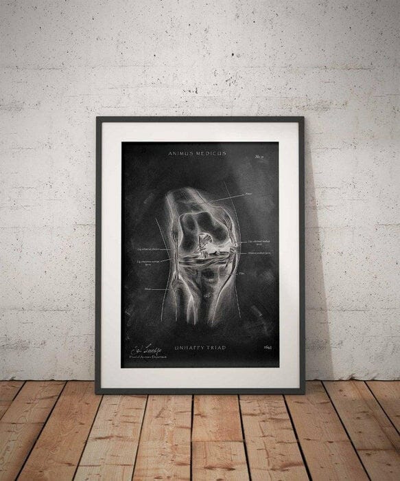 Customer photo review of Unhappy Triad Knie - Chalkboard