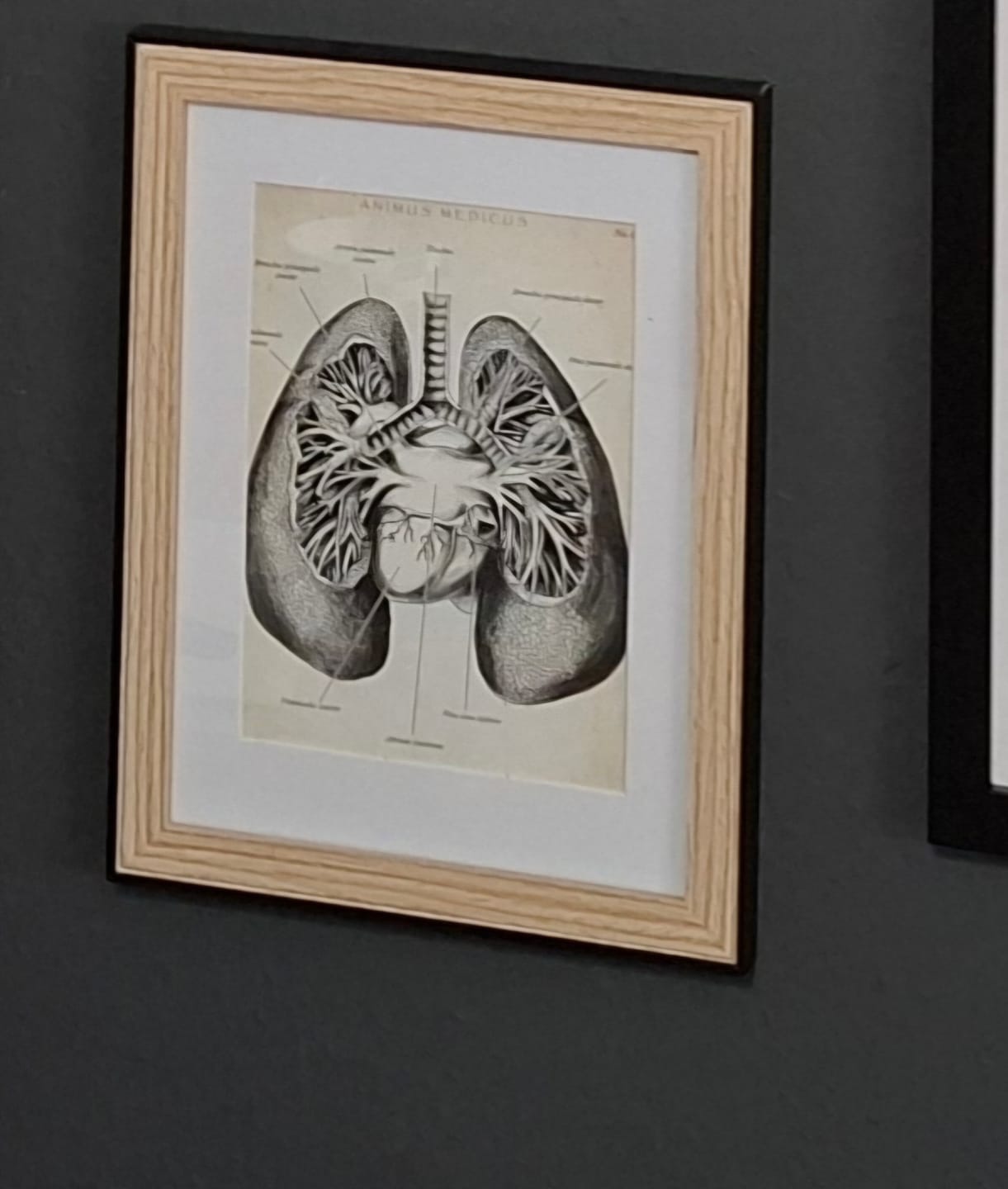 Customer photo review of Lungen Anatomie