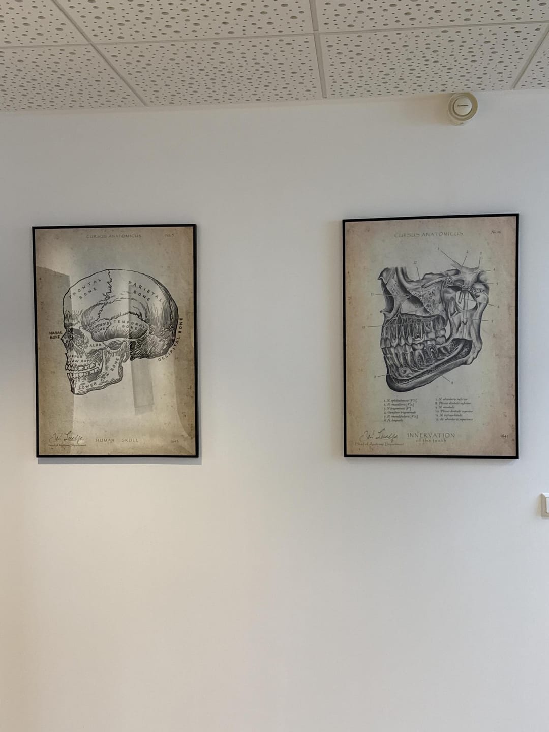Customer photo review of Hüftgelenk Anatomie