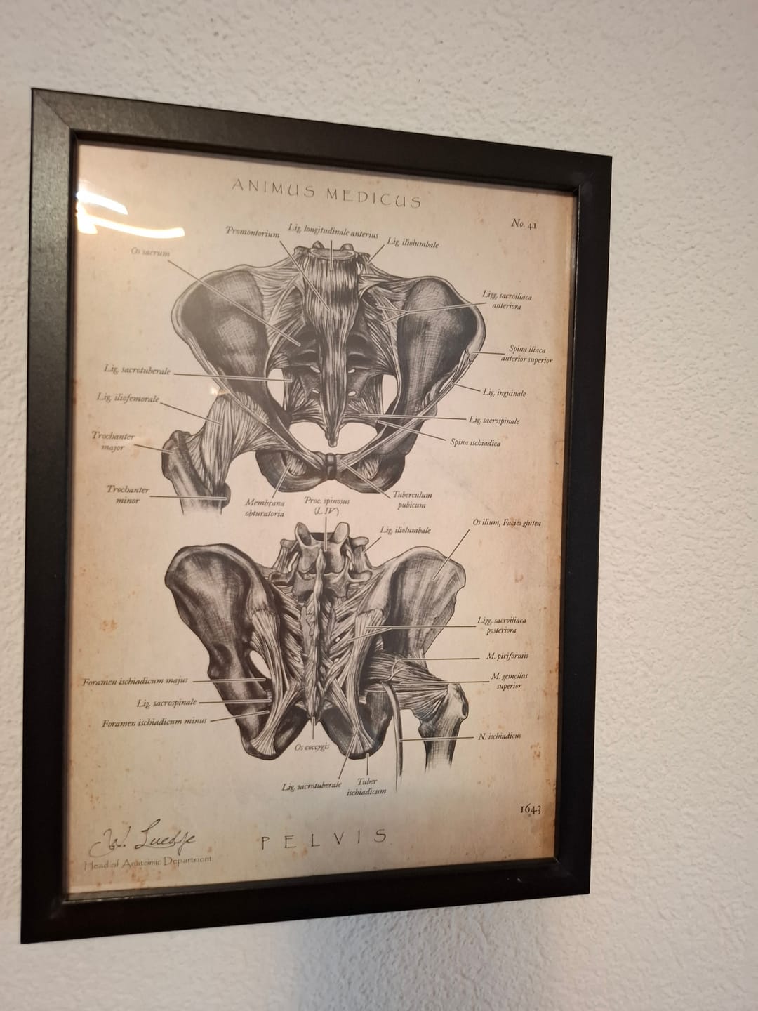 Customer photo review of Hüftgelenk Anatomie