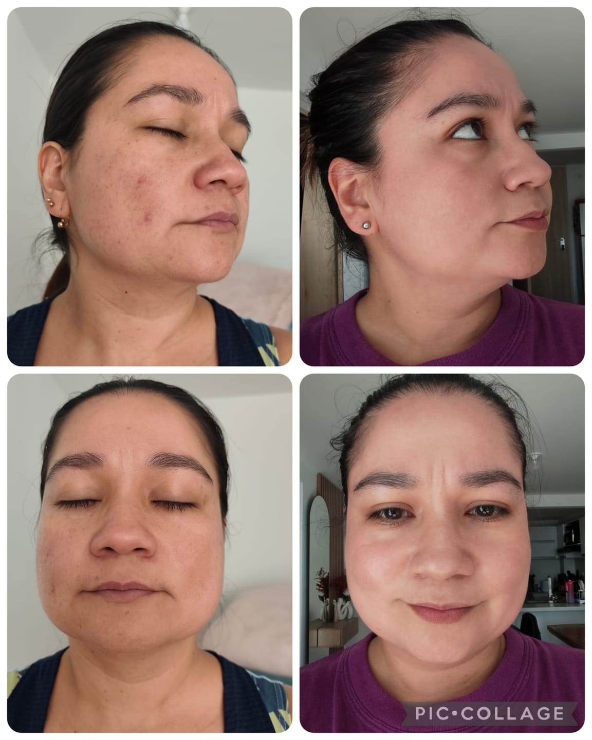 Customer photo review of Tónico Iluminador Aclarante