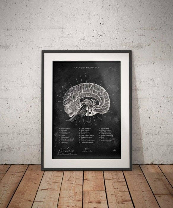 Customer photo review of Gehirn im Sagittalschnitt - Chalkboard