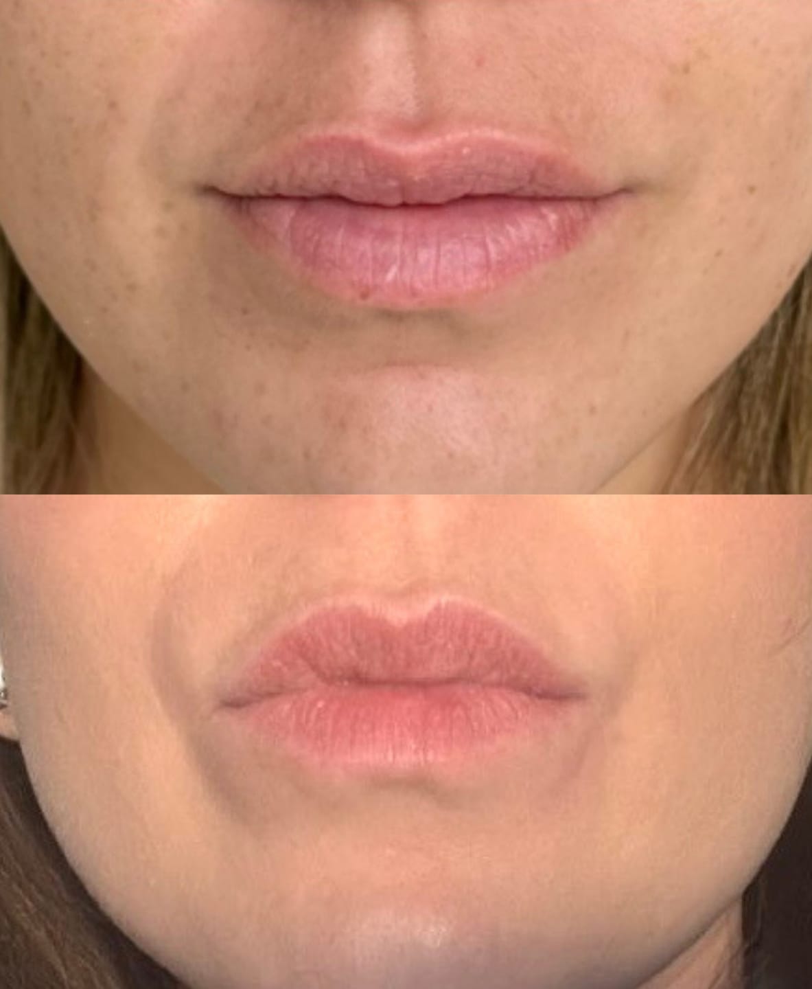 Customer photo review of 7 - Pret Exothion Powder