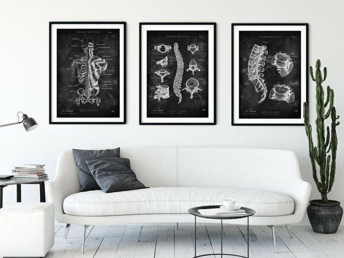 Customer photo review of Rücken Anatomie Sammlung - Chalkboard