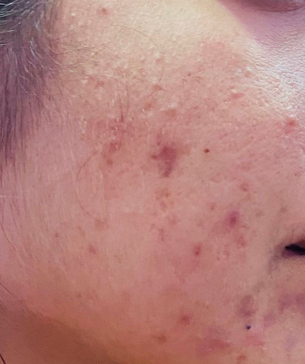 Customer photo review of Spectra Block Kids Spf50