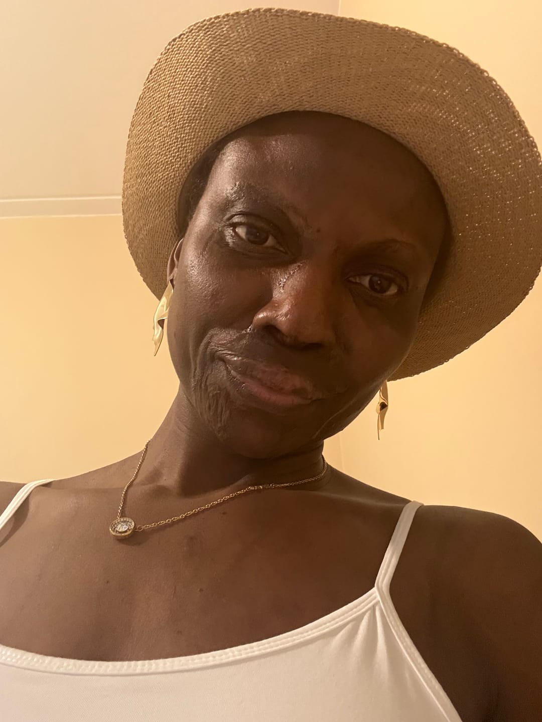 Customer photo review of Buy a Revitalizing Vitamin C Face Cream, Get a Free Vitamin C Serum
