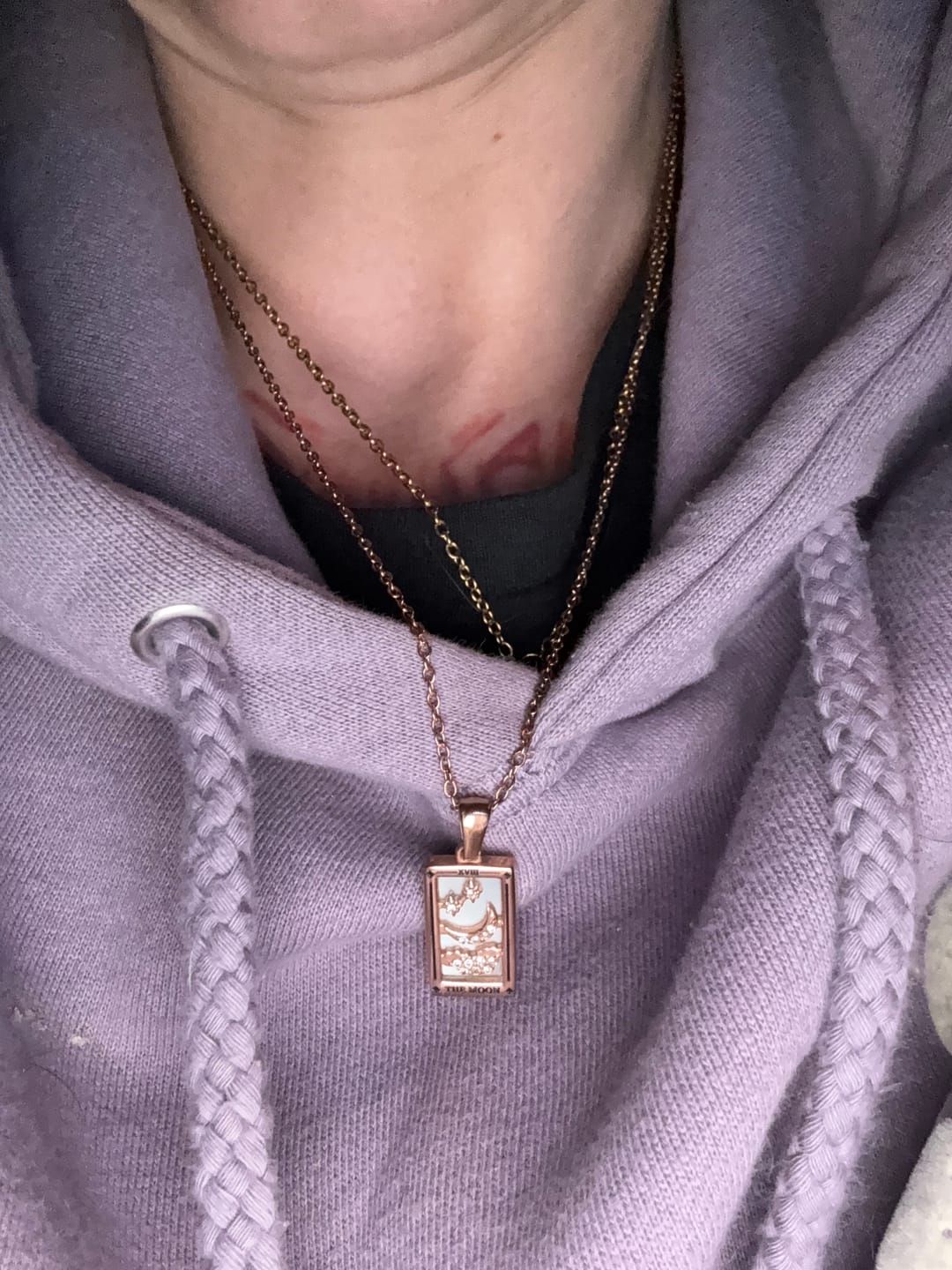 Customer photo review of Golden Fortune Necklace (Bundle)