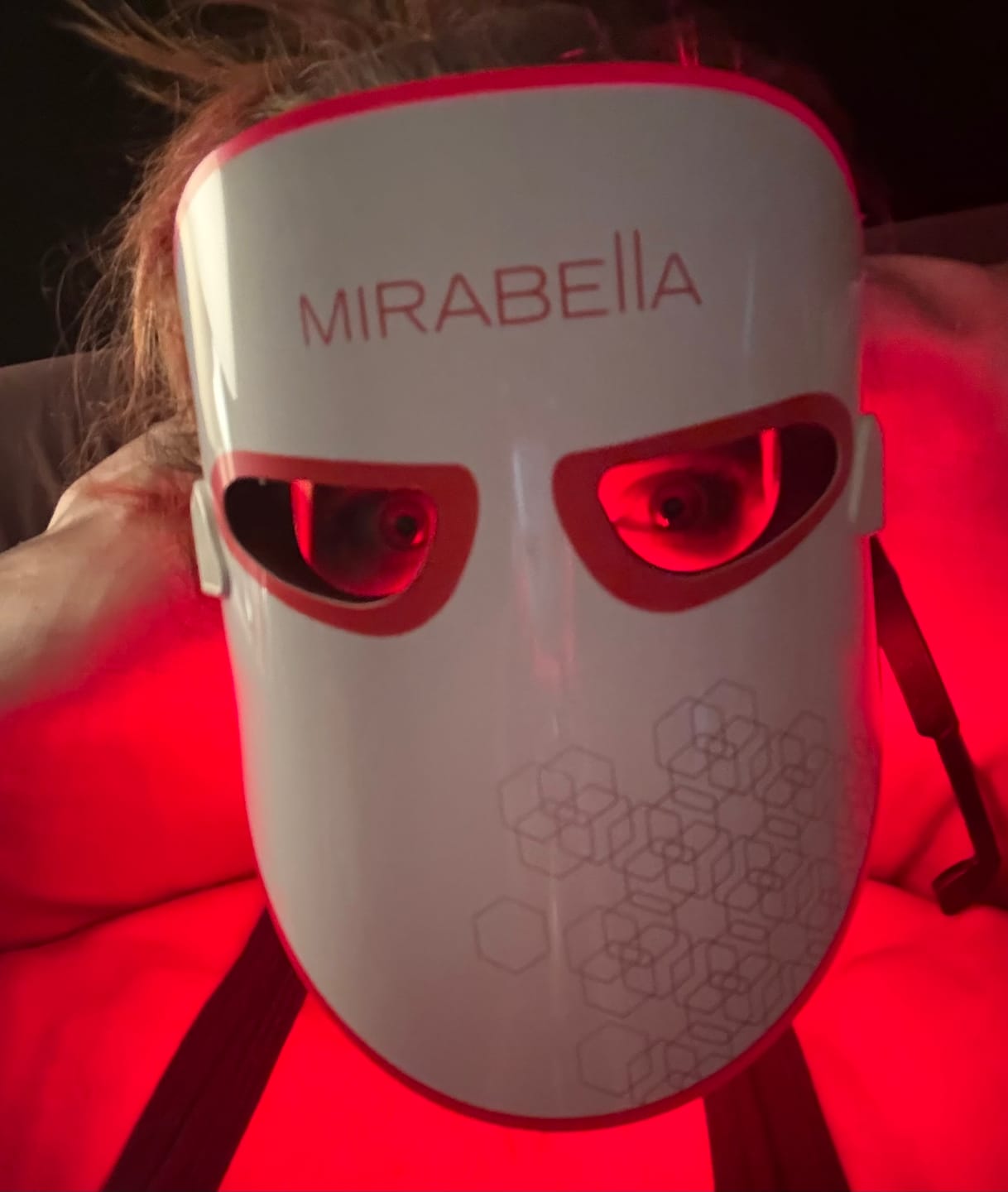 Customer photo review of Phototherapy 7-Color LED Facial Mask with Near Infrared