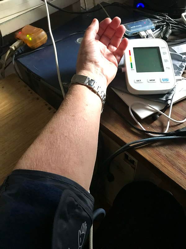 Customer photo review of Tensiomètre V1 Pro – Précision clinique et confort optimal pour un suivi fiable à domicile