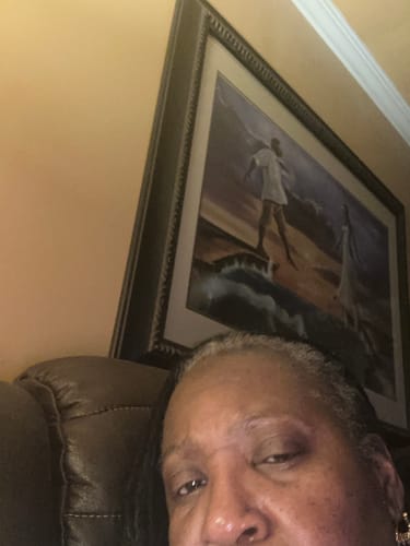 Customer photo review of 3 Step Grow My Edges Kit (Regular Strength)