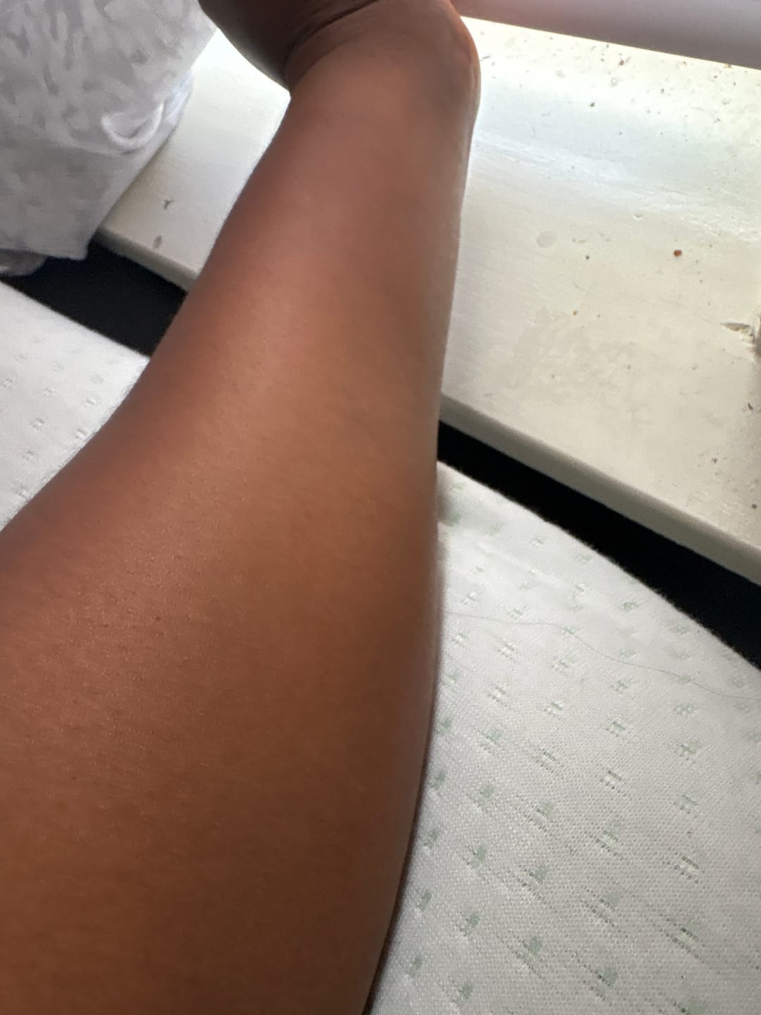 Customer photo review of Fair and White So White Skin Perfector Serum 30ml / 1 fl oz